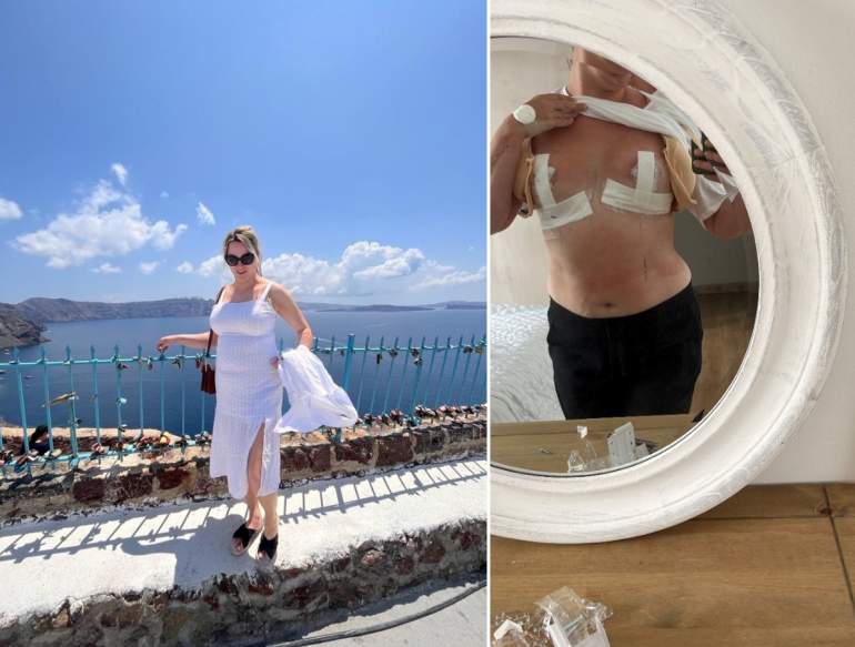 Британка, стыдившаяся своей большой груди, продала свой дом, чтобы сделать операцию по уменьшению груди