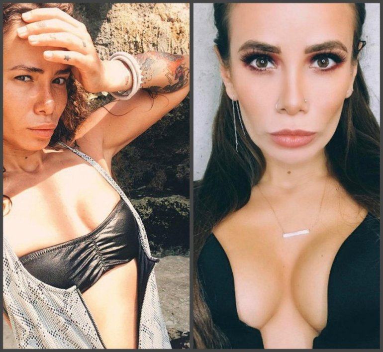 Красивые девушки и Айза анохина до пластики