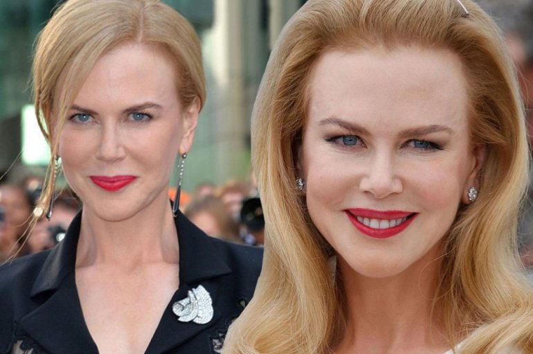 Красивые девушки и Николь кидман после пластики