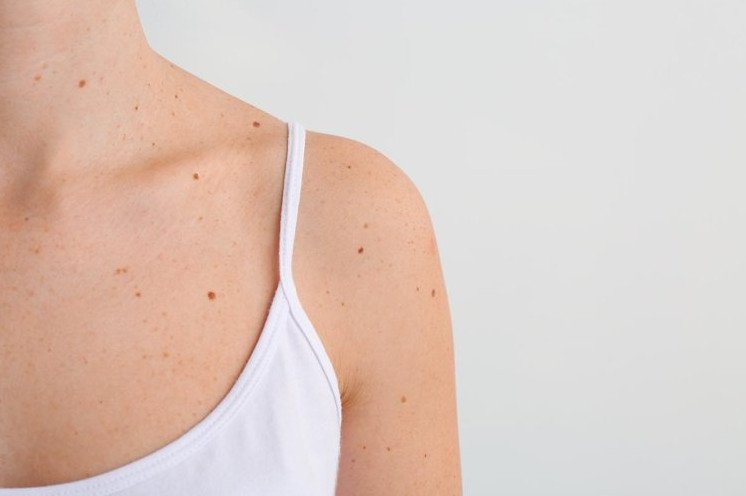 Девушка с родинкой на спине - фото