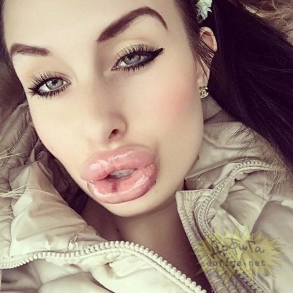 Красота или уродство: наченные губы у девушек